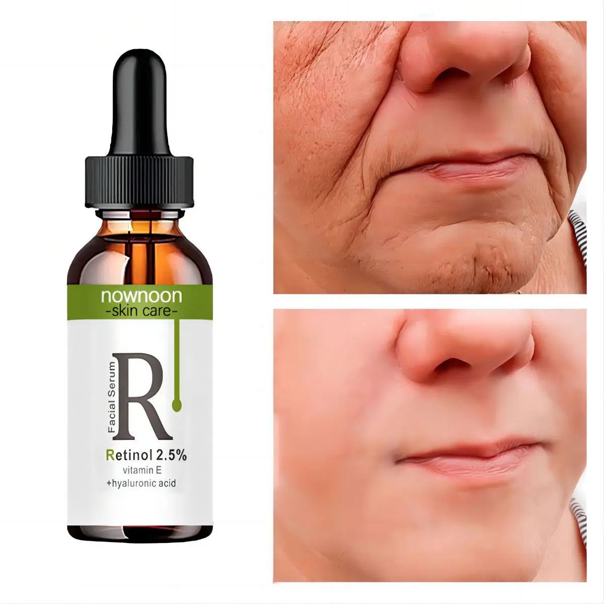 Radiant Retinol & Vitamin C Serum – Anti-Wrinkle & Dark Spot Fading Facial Essence